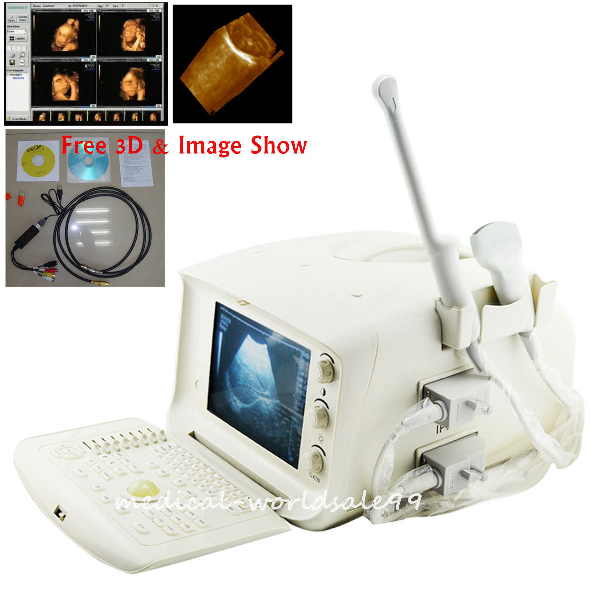 USB Port Digital Ultrasonic Ultrasound Scanner Convex +Transvaginal 2 Probe Sale DIAGNOSTIC ULTRASOUND MACHINES FOR SALE