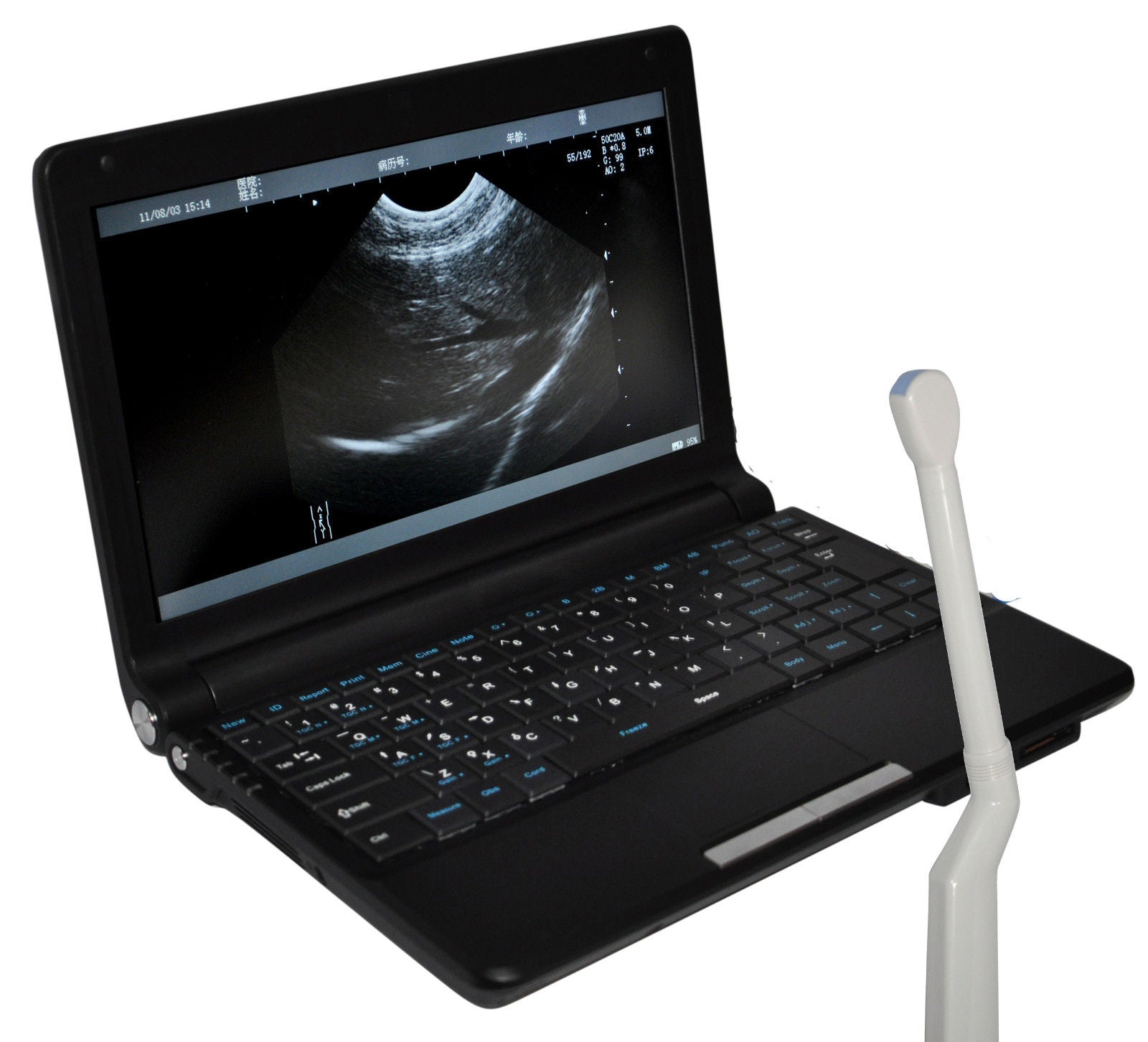 CE Digital Laptop Ultrasound Machine Scanner System 6.5Mhz Transvaginal probe 3D 190891224682 DIAGNOSTIC ULTRASOUND MACHINES FOR SALE