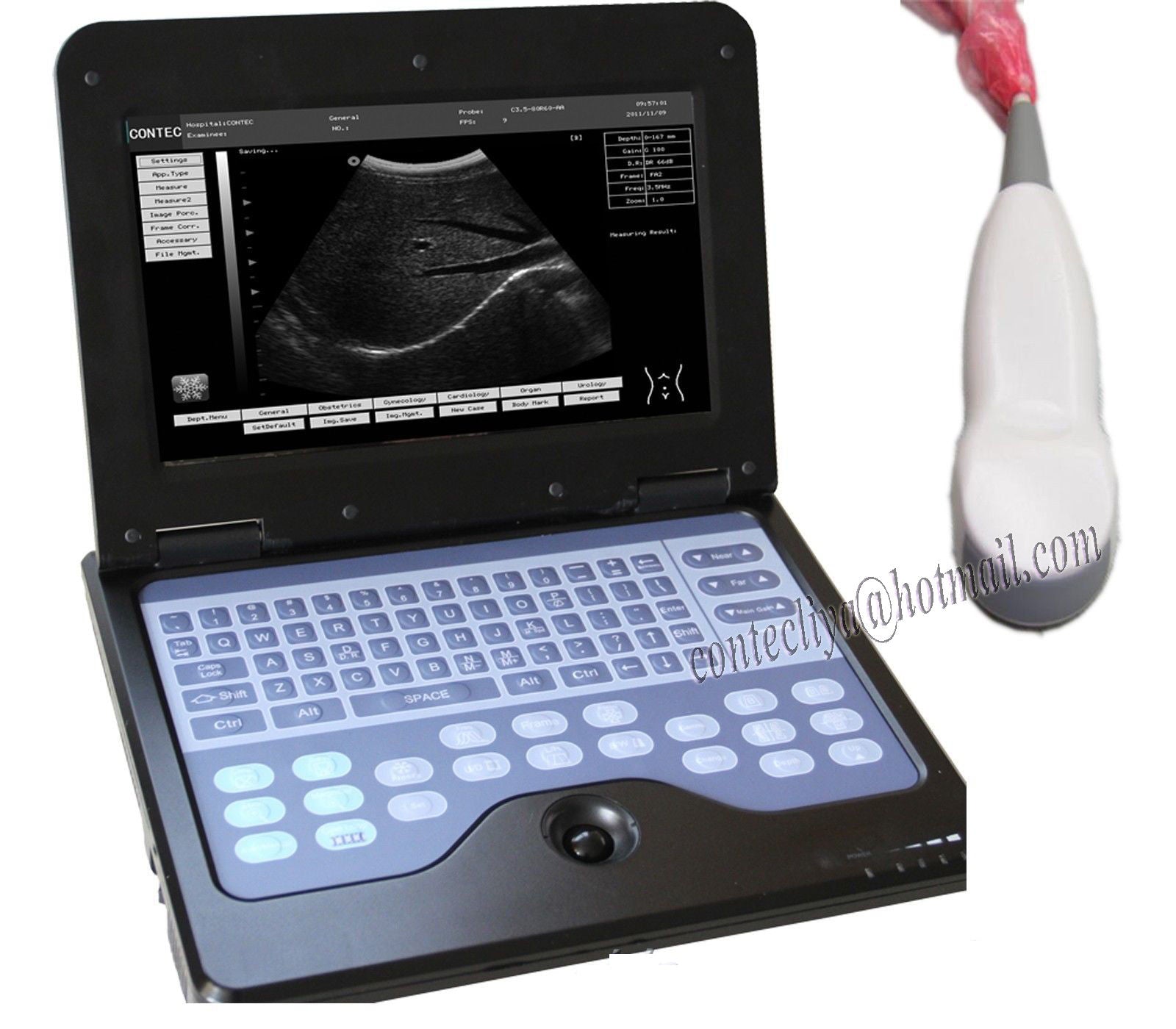 CE Digital Ultrasound Scanner Laptop Machine Diagnostic System Optional 4 Probe DIAGNOSTIC ULTRASOUND MACHINES FOR SALE