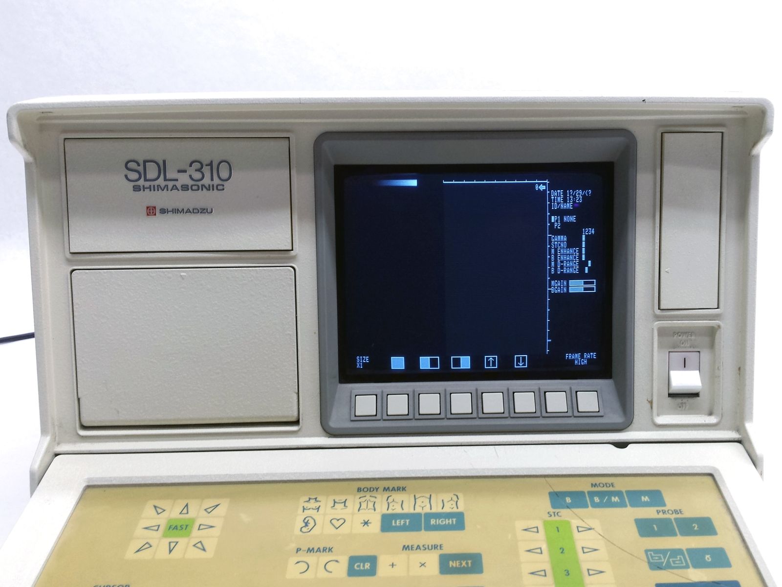 SHIMADZU SHIMASONIC SDL-310 OB/GYN ULTRASOUND DIAGNOSTIC IMAGING PATIENT MONTIOR DIAGNOSTIC ULTRASOUND MACHINES FOR SALE