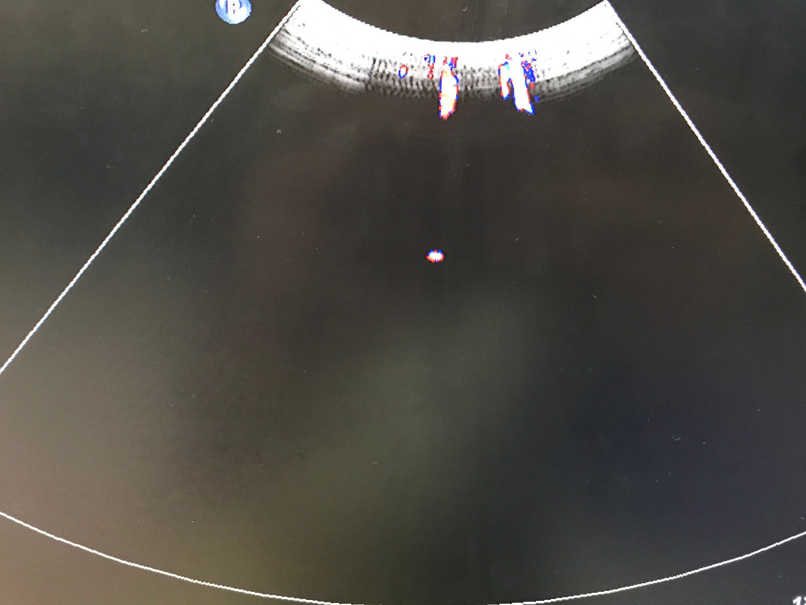 picture of ultrasound transducer medical