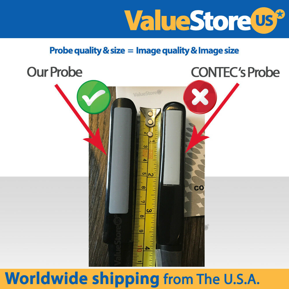 Portable Ultrasound Scanner V16 with 3.5 MHz Convex & 7.5 MHz Rectal Probe DIAGNOSTIC ULTRASOUND MACHINES FOR SALE