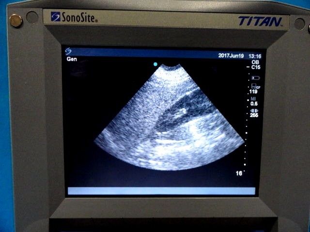 2008 Sonosite C15 / 4-2 MHz Convex Array Probe for Sonosite Titan 180 Plus~12892 DIAGNOSTIC ULTRASOUND MACHINES FOR SALE