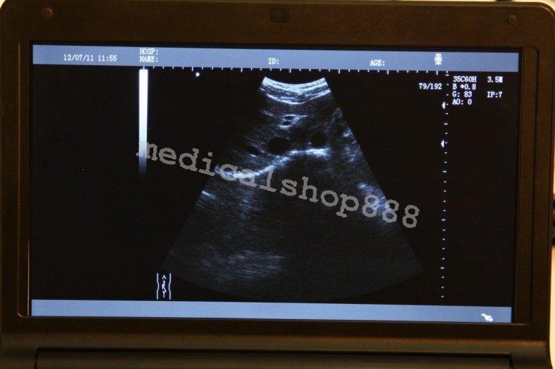 Sale! 10Inch  Laptop Ultrasound Scanner with linear probe 3D Ultrasound Device 190891478627 DIAGNOSTIC ULTRASOUND MACHINES FOR SALE