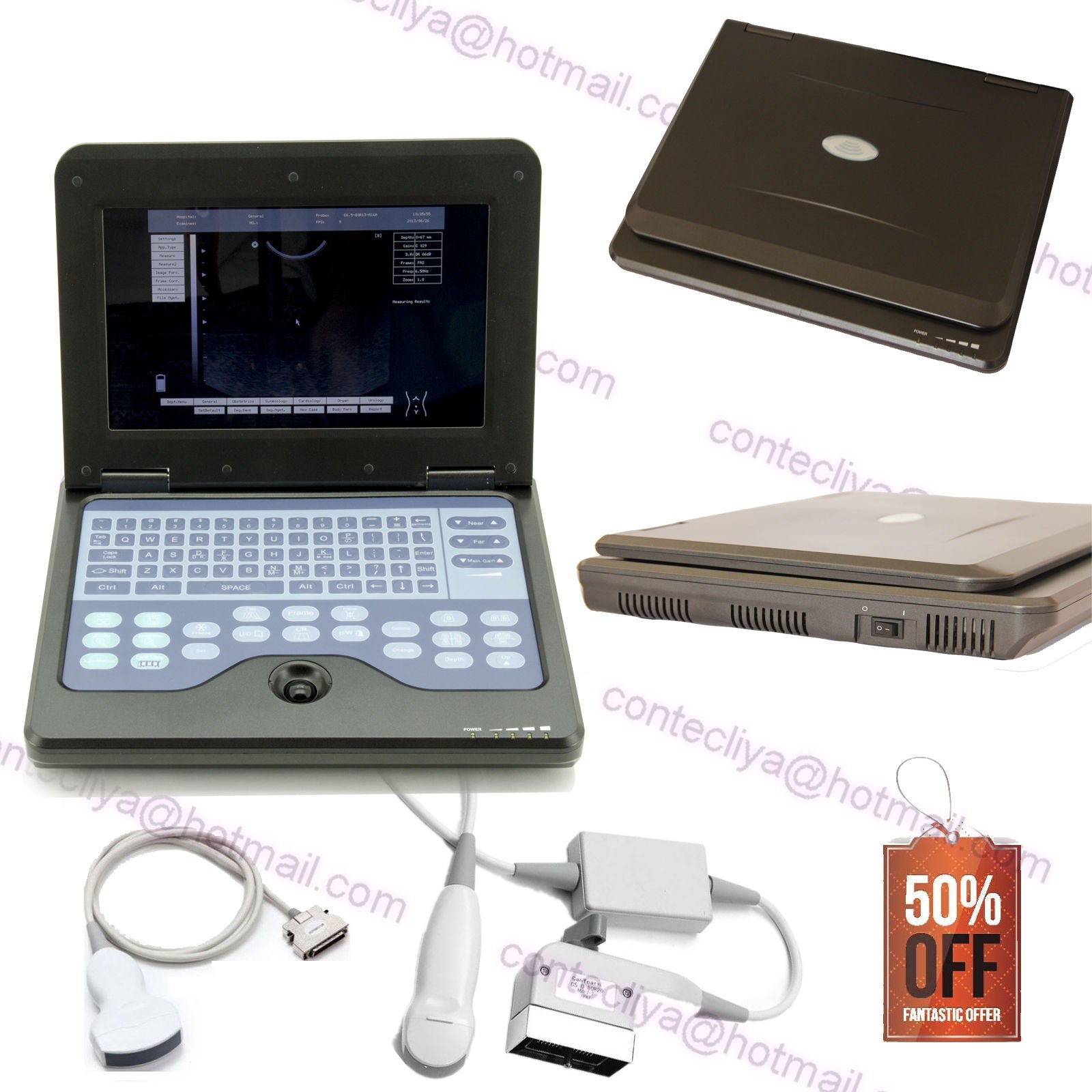 CE Digital Ultrasound Scanner Laptop Machine Diagnostic System Optional 4 Probe DIAGNOSTIC ULTRASOUND MACHINES FOR SALE