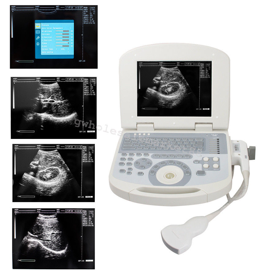 US Hot Portable Ultrasound Machine Scanner System Convex probe 3D Software Image 190891045898 DIAGNOSTIC ULTRASOUND MACHINES FOR SALE