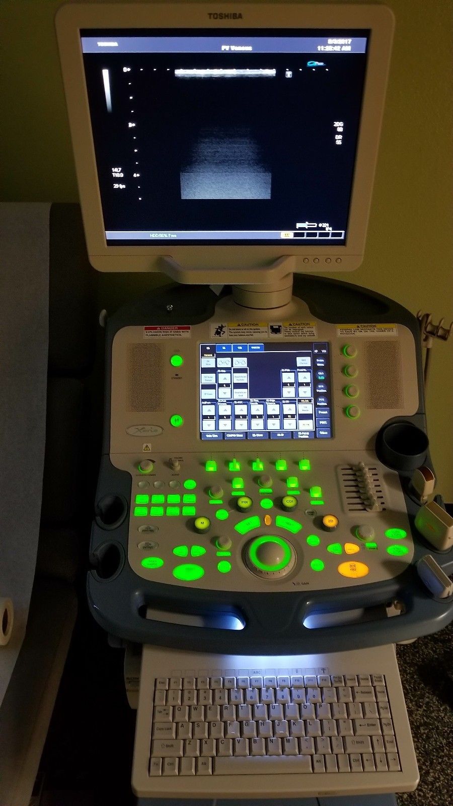 Toshiba Xario SSA-660A Ultrasound with THREE Probes – Excellent Condition!!! DIAGNOSTIC ULTRASOUND MACHINES FOR SALE