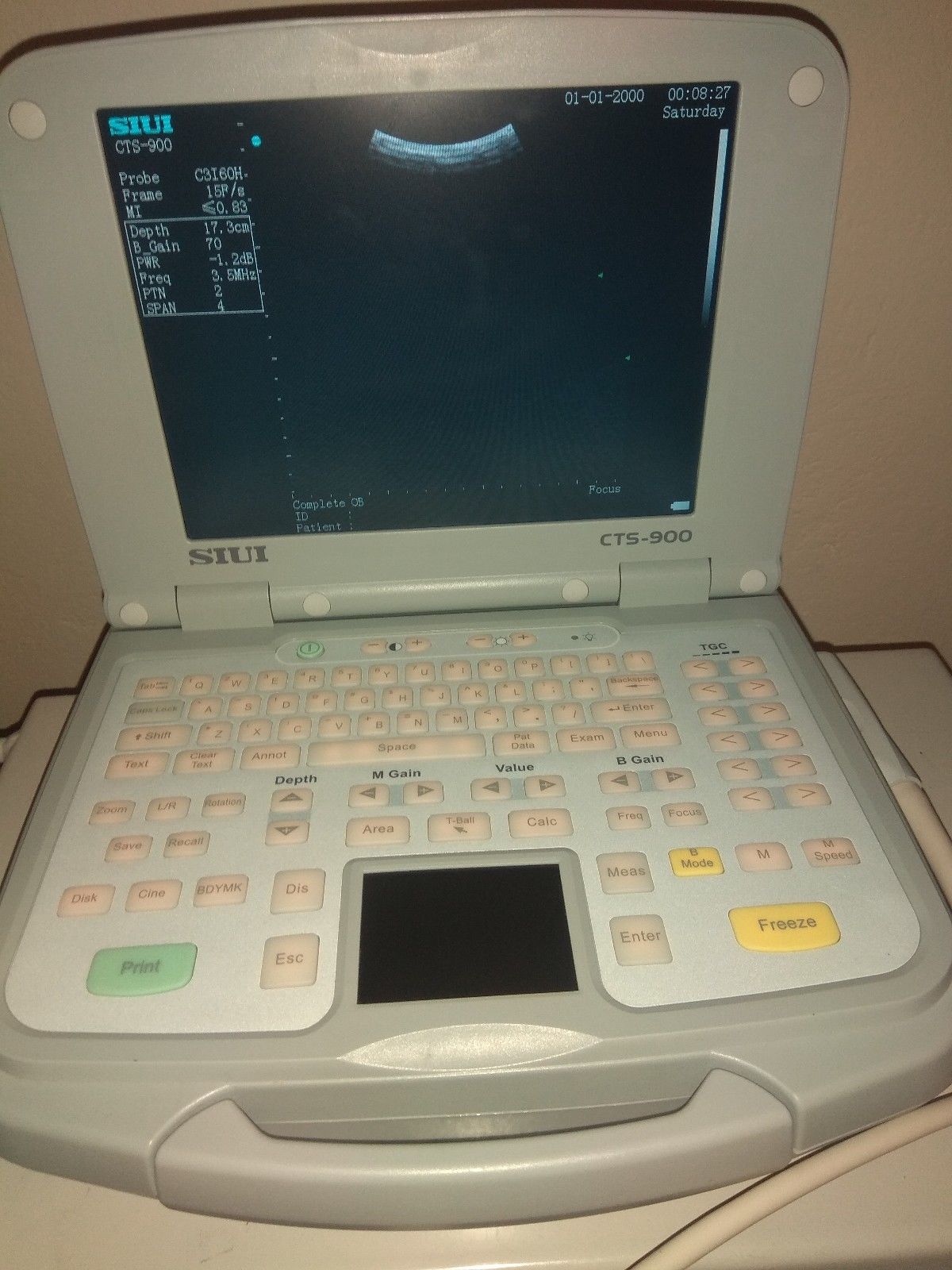 USG UltraSound SIUI CTS-900 DIAGNOSTIC ULTRASOUND MACHINES FOR SALE