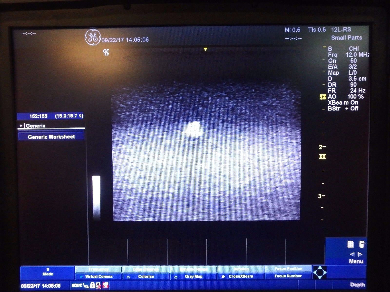 GE LOGIQ-e BT12 Portable 3D Ultrasound w/ 12L-RS Linear & 4C-RS Convex Probes DIAGNOSTIC ULTRASOUND MACHINES FOR SALE