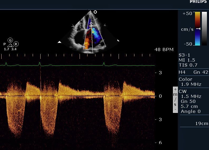 an image of a sound wave on a computer screen