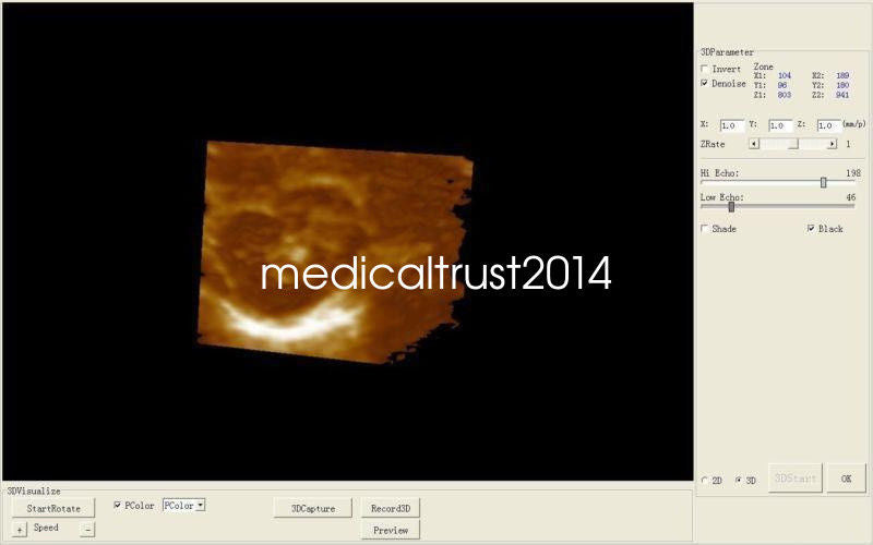 Medical Ultrasound Scanner Equip convex N Linear Probe N 3D Image Hospital USE DIAGNOSTIC ULTRASOUND MACHINES FOR SALE