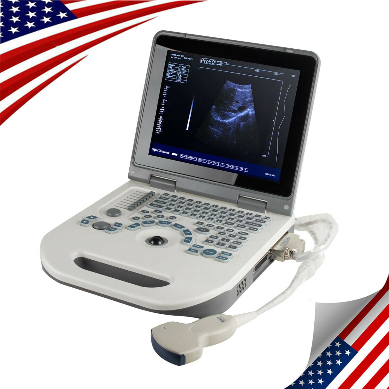 Portable Digital Ultrasound Scanner Ultrasonic MachineDisgnos Convex Probe 3D CE DIAGNOSTIC ULTRASOUND MACHINES FOR SALE