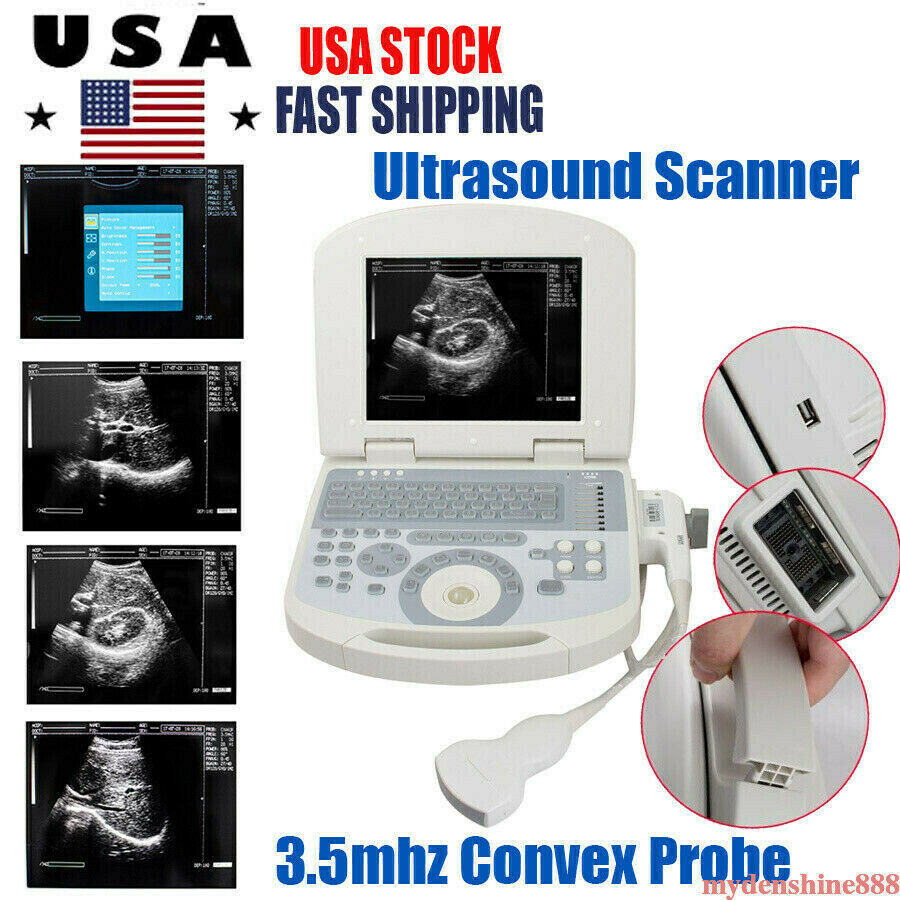 Portable Full 3D Digital Laptop Ultrasound Scanner System Machine + Convex Probe DIAGNOSTIC ULTRASOUND MACHINES FOR SALE