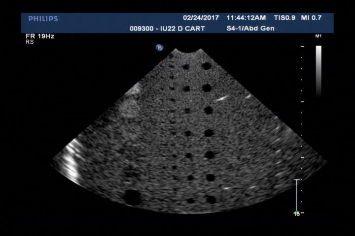 image of ultrasound