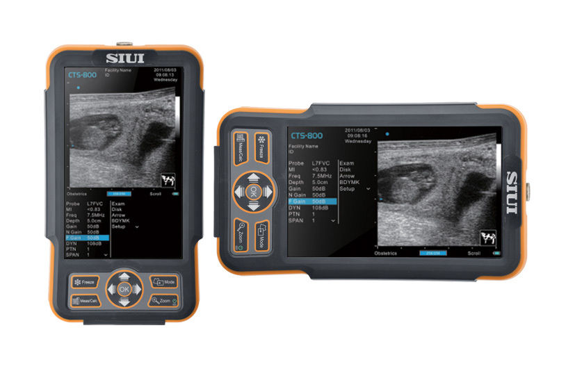 SIUI CTS-800 Veterinary Ultrasound with Linear Probe DIAGNOSTIC ULTRASOUND MACHINES FOR SALE