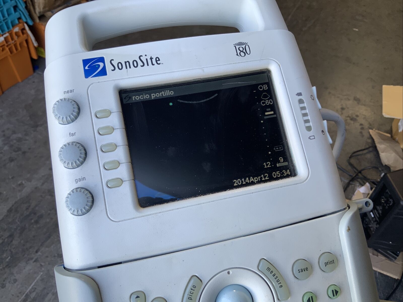 Sonosite 180 Ultrasound W C60/5-2mhz & ICT/7-4mhz Transducers DIAGNOSTIC ULTRASOUND MACHINES FOR SALE