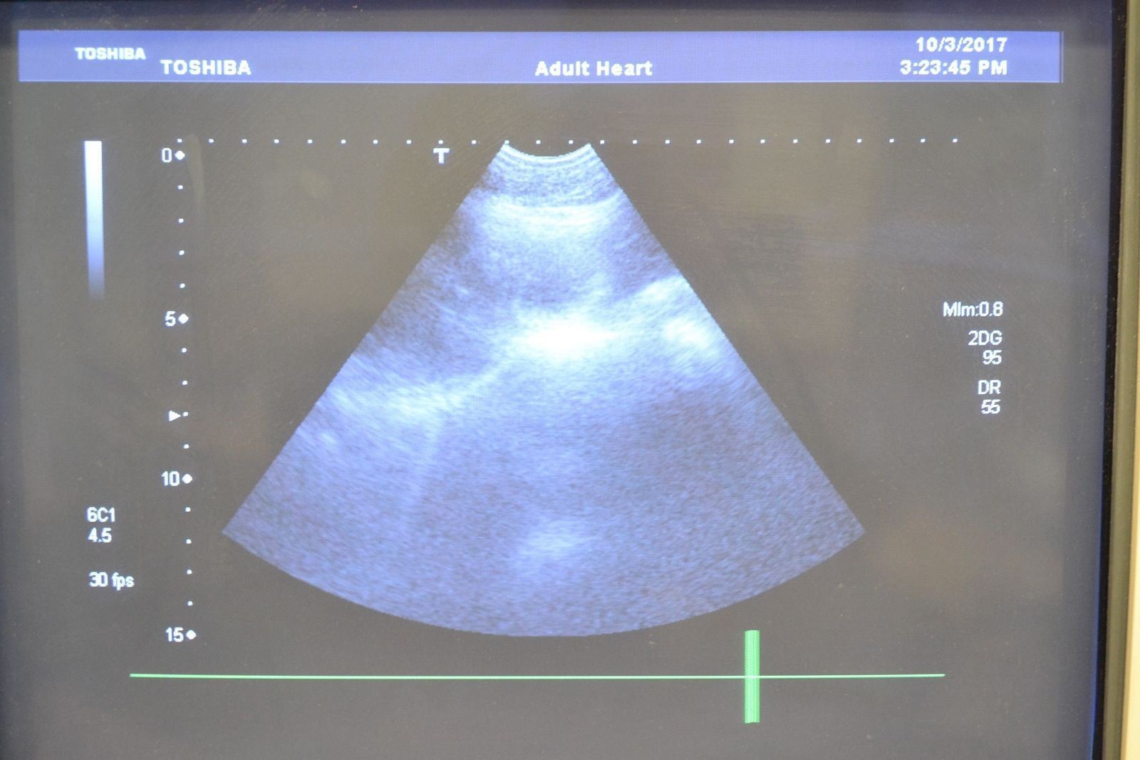 Toshiba Viamo PVT-382BT 5.5-1.8MHz Convex Ultrasound Transducer Probe J1641 DIAGNOSTIC ULTRASOUND MACHINES FOR SALE