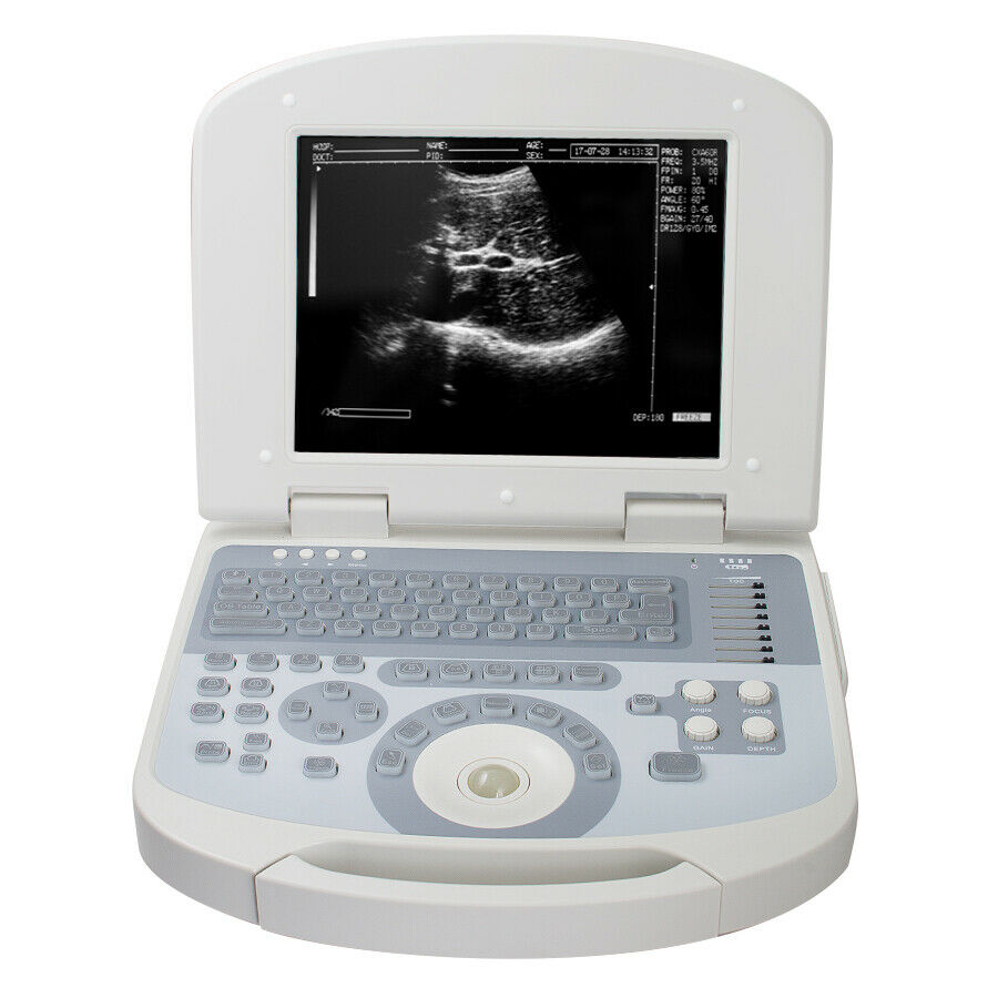 Portable Laptop Ultrasound Scanner 3.5MHz Convex Medical Ultrasound Machine +3D DIAGNOSTIC ULTRASOUND MACHINES FOR SALE