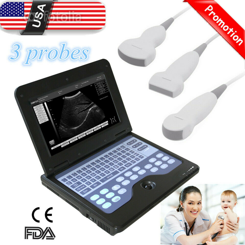 New Portable Ultrasound Scanner Machine 3 probes Convex+Linear+Cardiac,US Seller 6945040100362 DIAGNOSTIC ULTRASOUND MACHINES FOR SALE