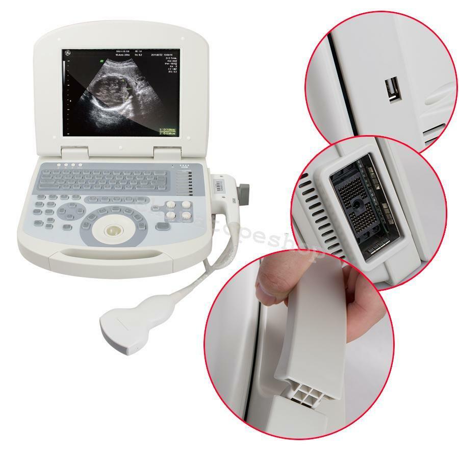Notebook/Laptop Digital Ultrasound Scanner Convex/Abdominal Probe US STOCK DIAGNOSTIC ULTRASOUND MACHINES FOR SALE