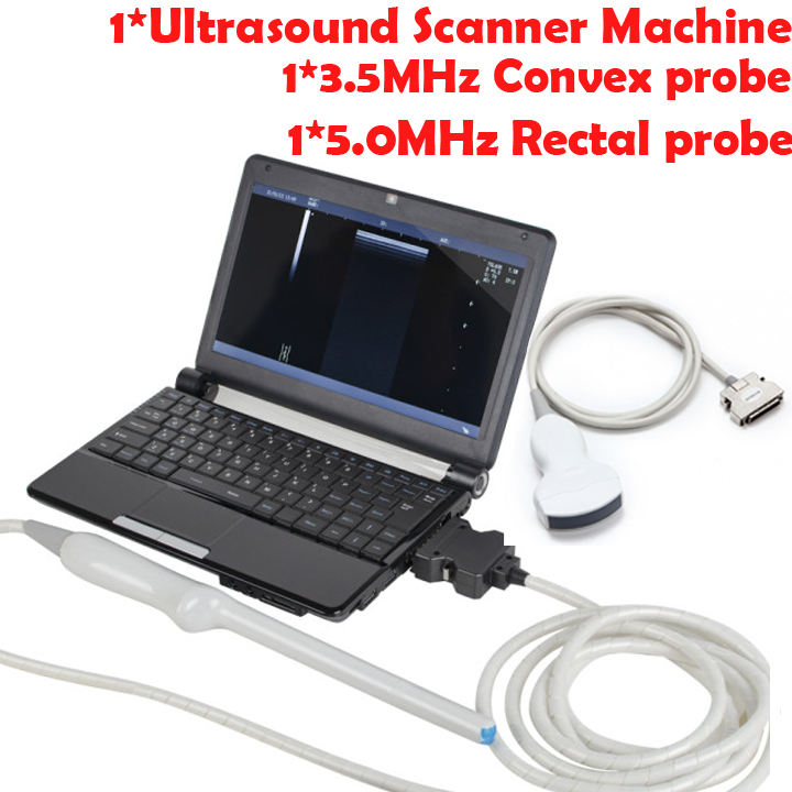 Medical Laptop Machine Ultrasound Scanner 7.5MHz Linear Transvaginal  2 Probes DIAGNOSTIC ULTRASOUND MACHINES FOR SALE