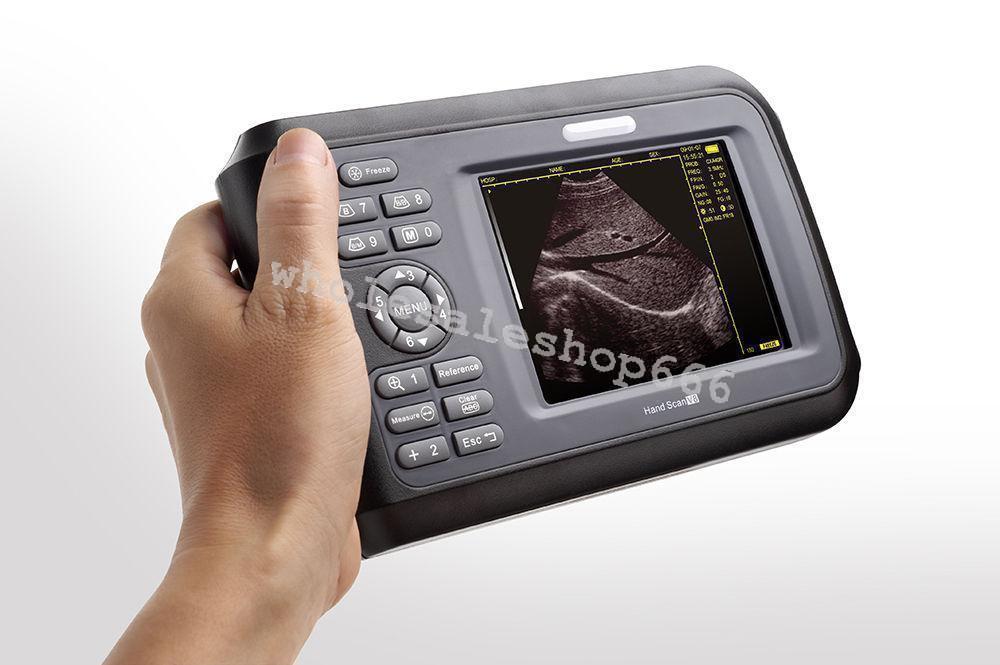 Portable Handheld Digital Ultrasound HandScan Scanner +Convex Probe Obstetrics DIAGNOSTIC ULTRASOUND MACHINES FOR SALE