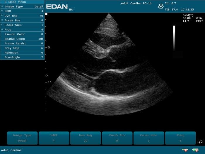 Edan U50 Prime Veterinary Ultrasound Machine. Microconvex & Phased Array Probes. DIAGNOSTIC ULTRASOUND MACHINES FOR SALE