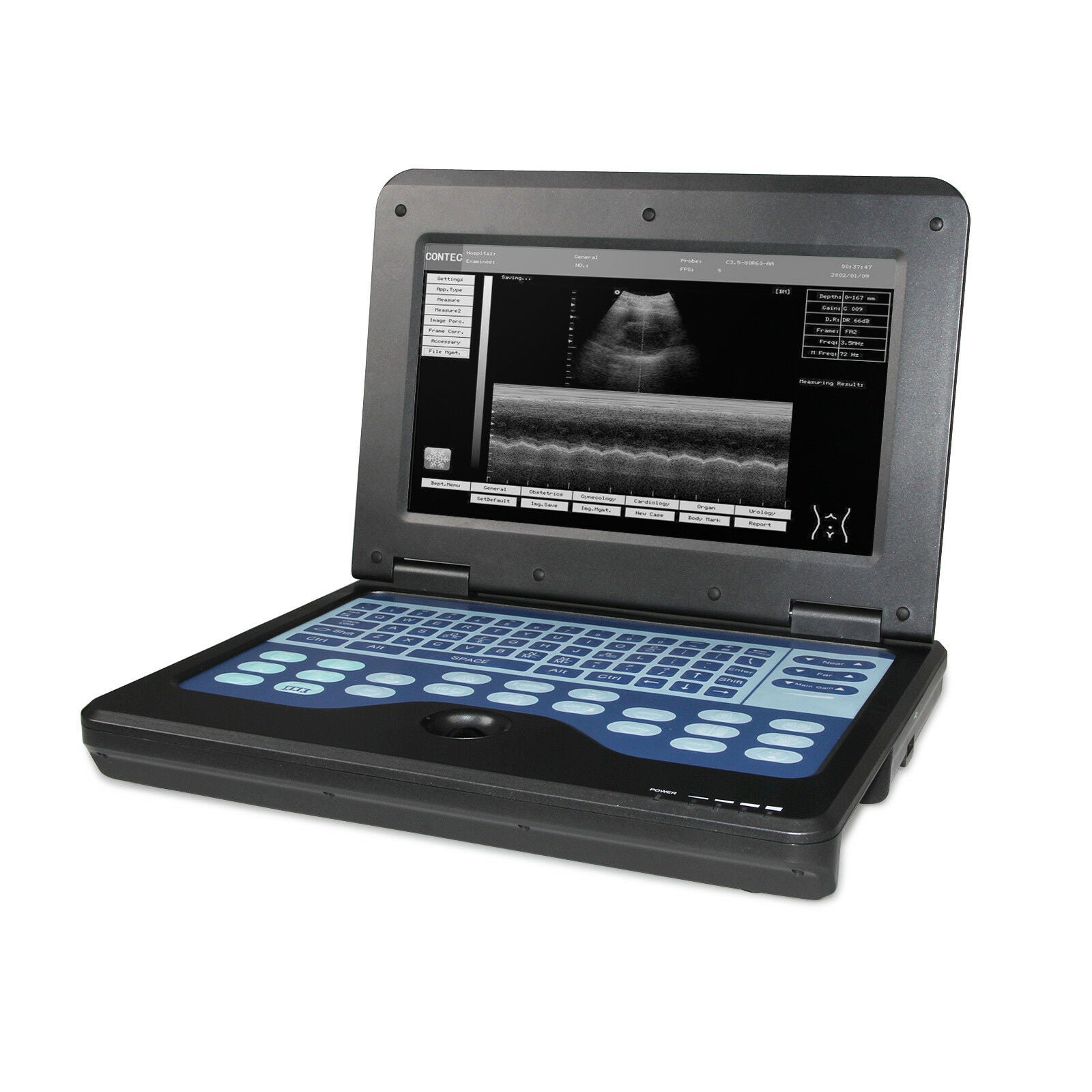 USA,Portable Ultrasound Scanner Laptop Machine Convex/Linear/Cardiac/Tranvaginal DIAGNOSTIC ULTRASOUND MACHINES FOR SALE