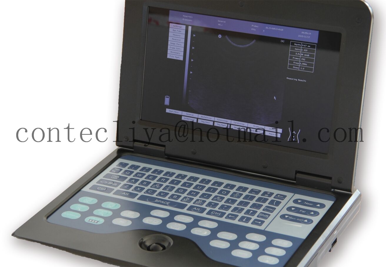 USA Ultrasound Scanner Laptop Diagnostic Ultrasonic Systems Convex+Linear Probe DIAGNOSTIC ULTRASOUND MACHINES FOR SALE