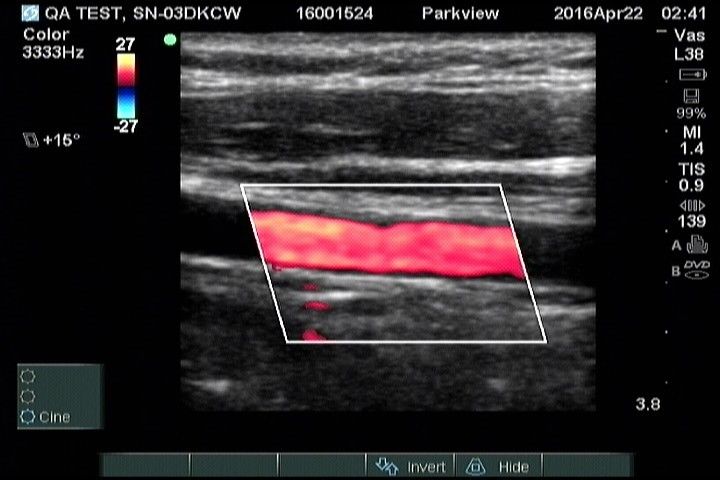 Sonosite M-Turbo Portable Ultrasound System DIAGNOSTIC ULTRASOUND MACHINES FOR SALE