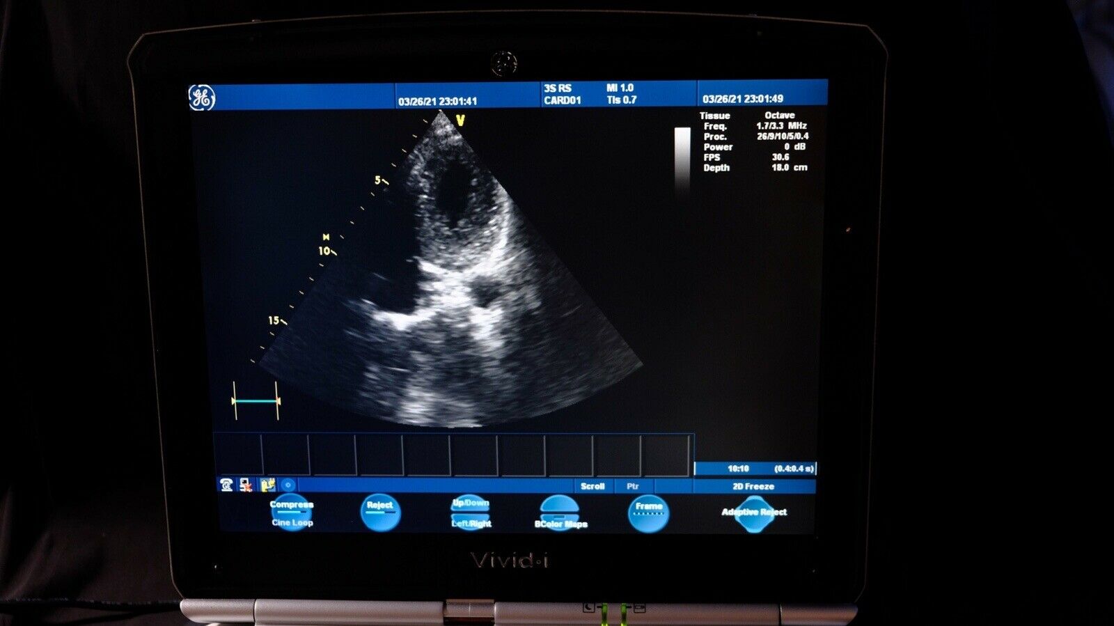 GE Logiq E Ultrasound System Version 5.. With CW option. Sector 3srs DIAGNOSTIC ULTRASOUND MACHINES FOR SALE
