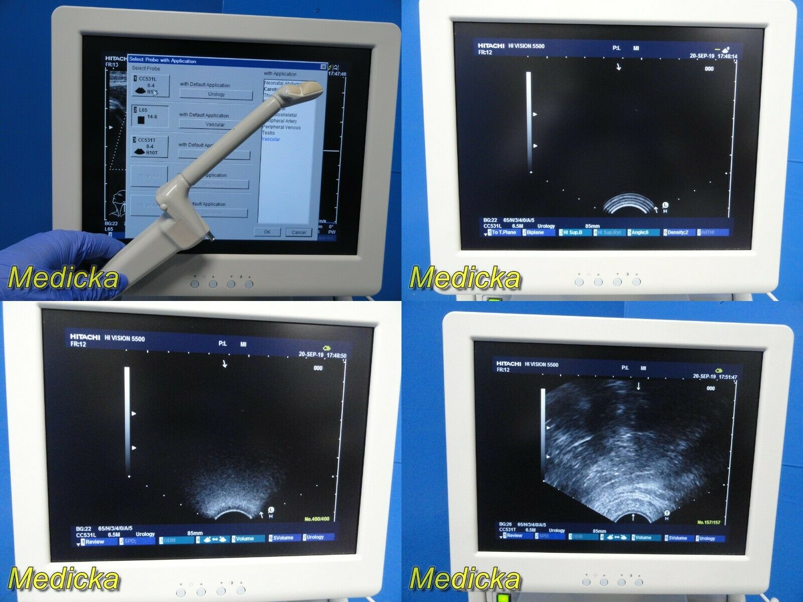 2010 Hitachi Hi-Vision 5500 EUB-5500 Flat Screen Ultrasound W/ 2X Probes~19256 DIAGNOSTIC ULTRASOUND MACHINES FOR SALE