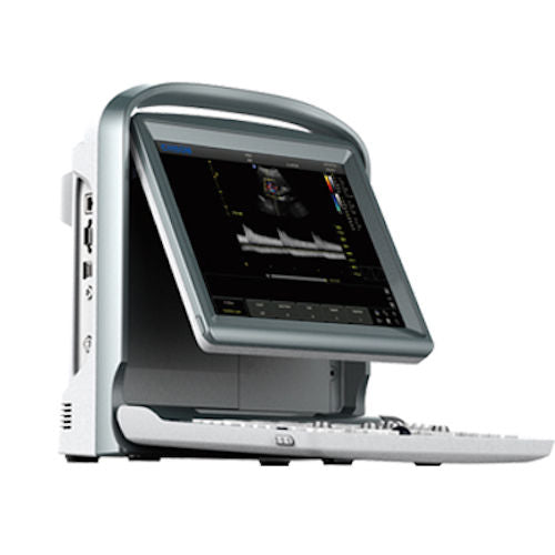 Affordable Color Doppler Ultrasound Machine Chison ECO5 With One Probe DIAGNOSTIC ULTRASOUND MACHINES FOR SALE