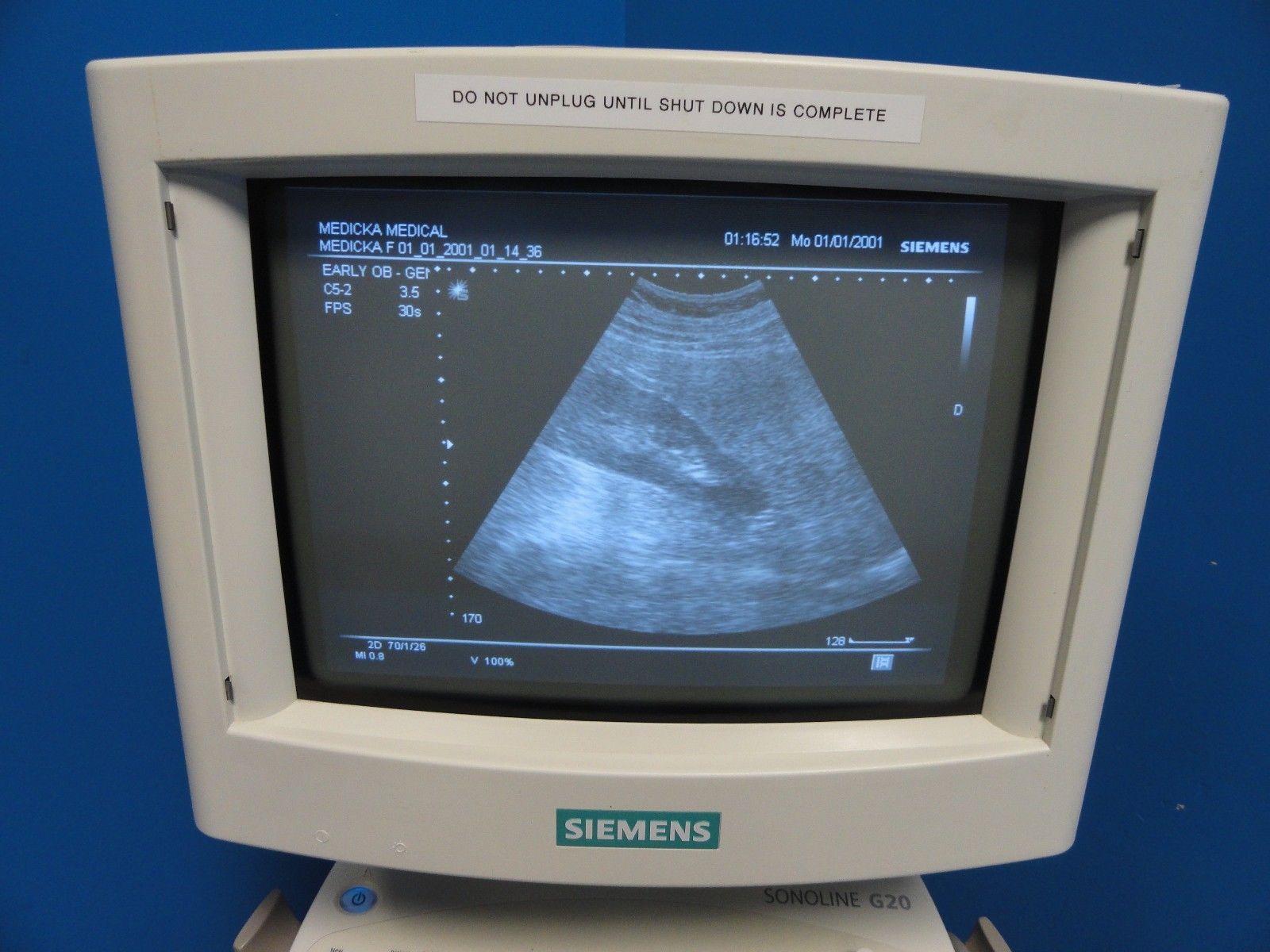 2004 Siemens Sonoline G20 Ultrasound W/ C5-2 & EV9-4 Probes Printer & UPS(10964) DIAGNOSTIC ULTRASOUND MACHINES FOR SALE