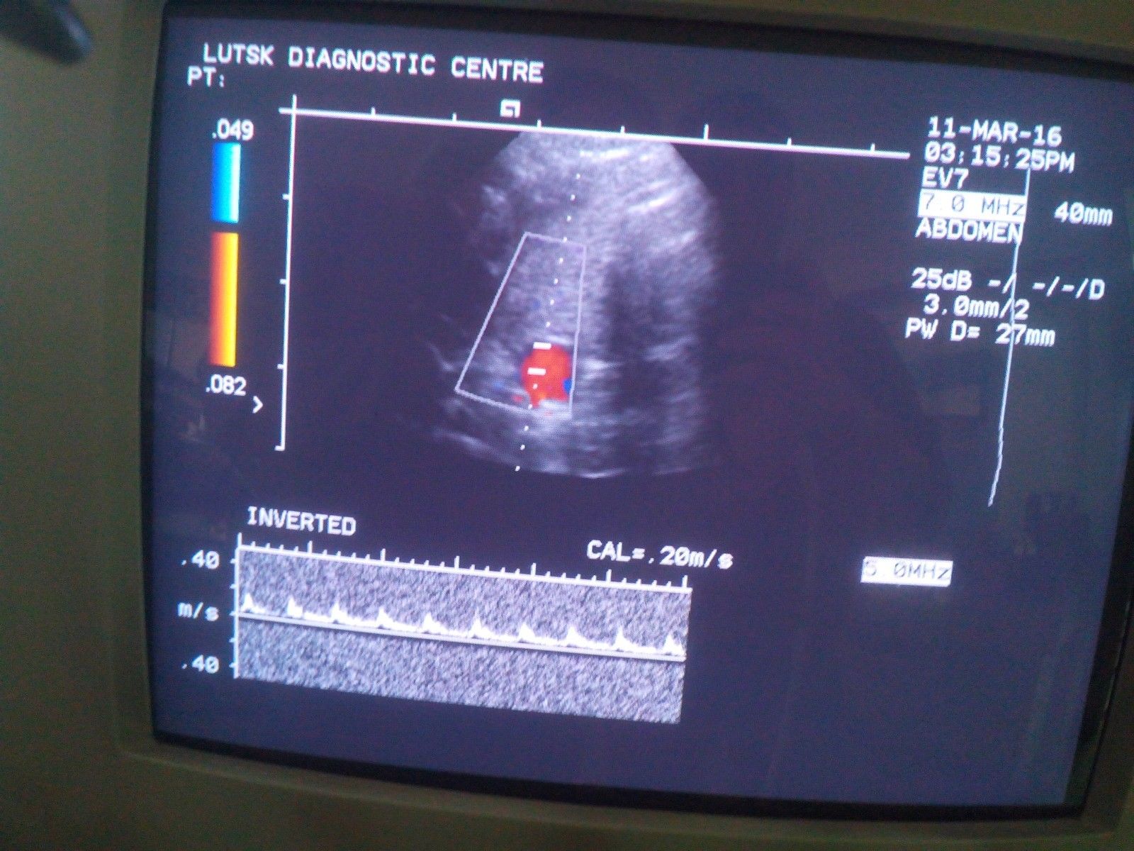 Ultrasound system Siemens Acuson Aspen for spare parts DIAGNOSTIC ULTRASOUND MACHINES FOR SALE