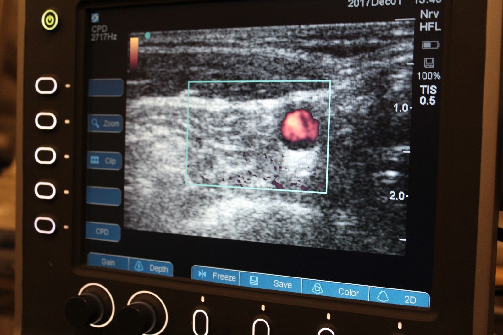 Sonosite S-Nerve vascular/nerve ultrasound with HFL38x-13-6 MHz transducer DIAGNOSTIC ULTRASOUND MACHINES FOR SALE