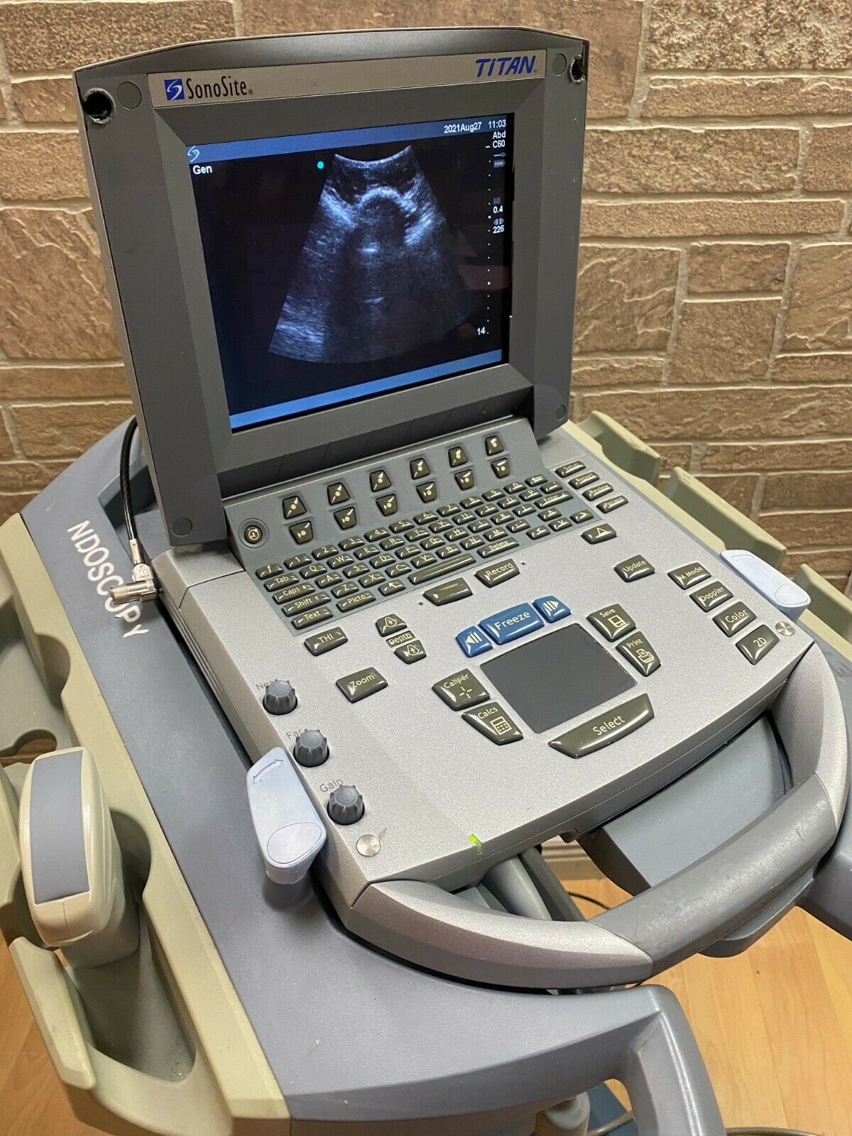 SONOSITE TITAN PORTABLE ULTRASOUND MACHINE WITH 1 PROBE (C60) DIAGNOSTIC ULTRASOUND MACHINES FOR SALE