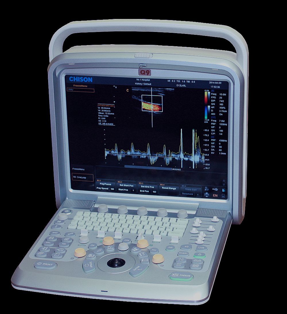 Chison Q9 Color Doppler Ultrasound Scanner & Two Probes Cardiac, Vascular DIAGNOSTIC ULTRASOUND MACHINES FOR SALE