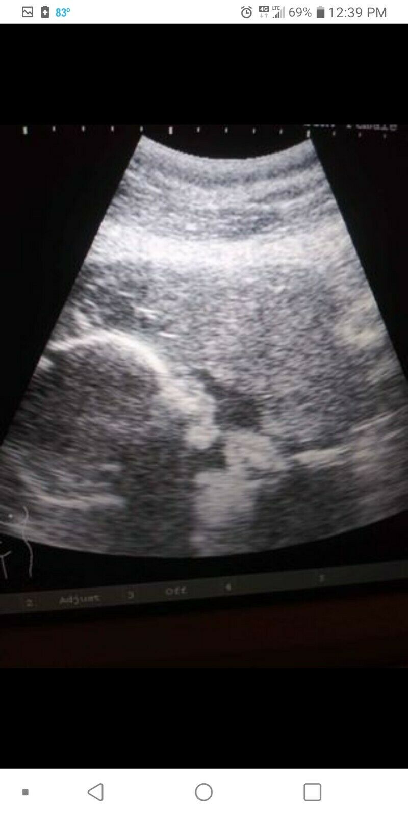 Portable Ultrasound Machine DIAGNOSTIC ULTRASOUND MACHINES FOR SALE