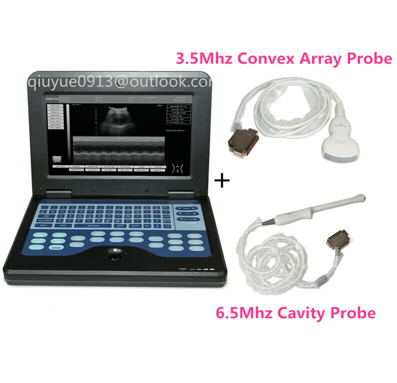 Digital Portable Ultrasound Machine Laptop Scanner with 2 Probes(Convex+Rectal） DIAGNOSTIC ULTRASOUND MACHINES FOR SALE