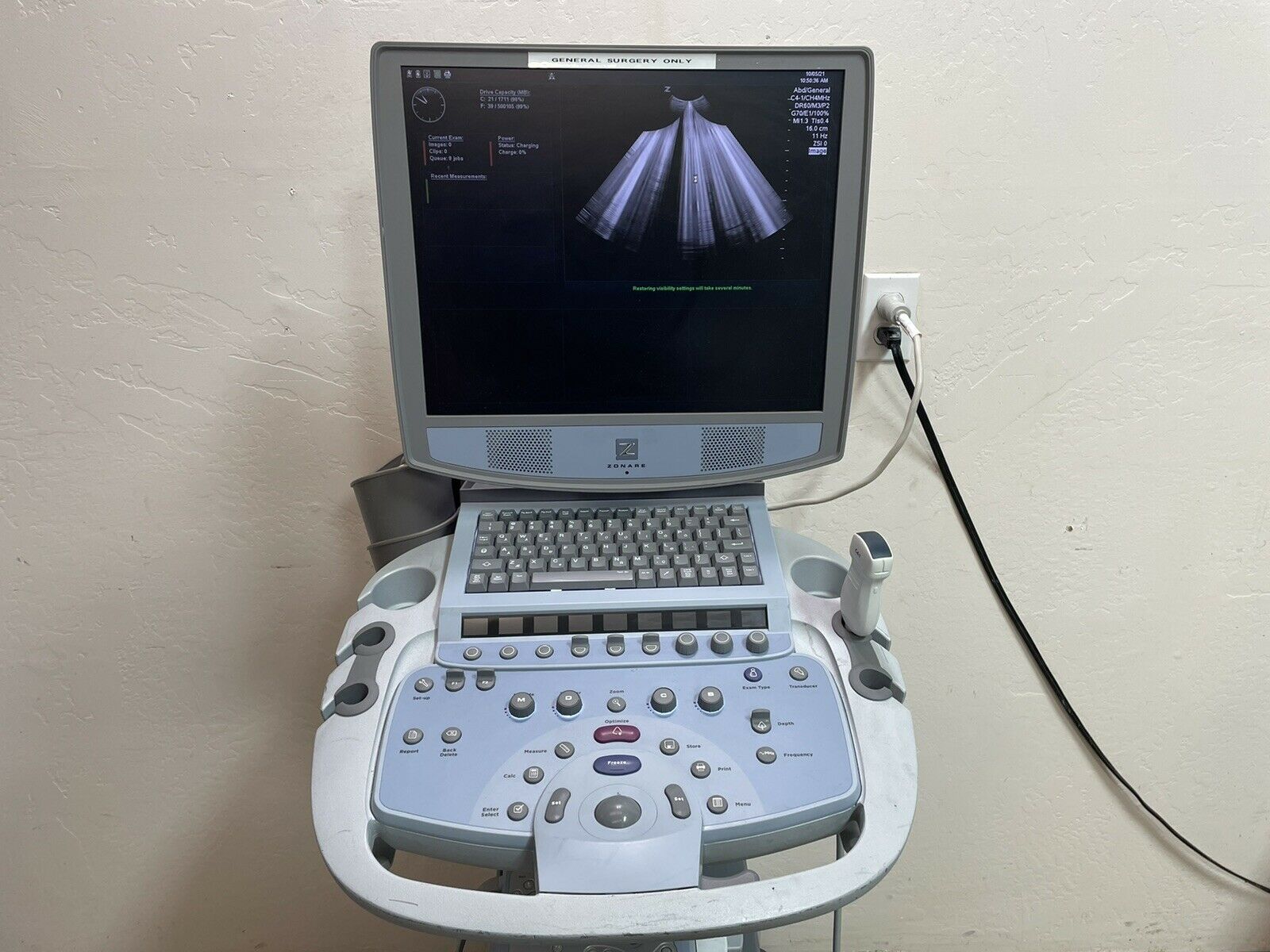 Zonare Z One Ultrasound System With Transducer And Printer DIAGNOSTIC ULTRASOUND MACHINES FOR SALE