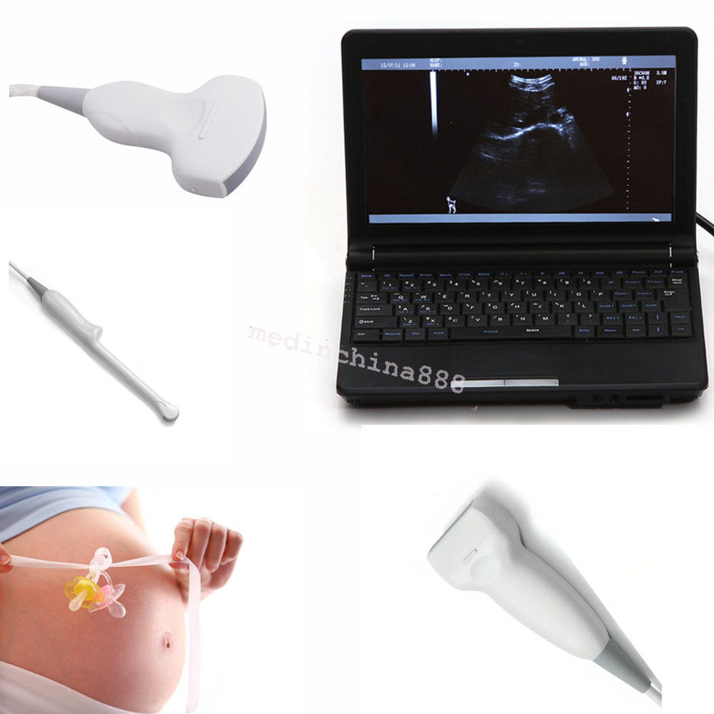 Clinc Laptop Ultrasound Scanner +Convex+Linear+Transvaginal 3 Probes +Free Box DIAGNOSTIC ULTRASOUND MACHINES FOR SALE