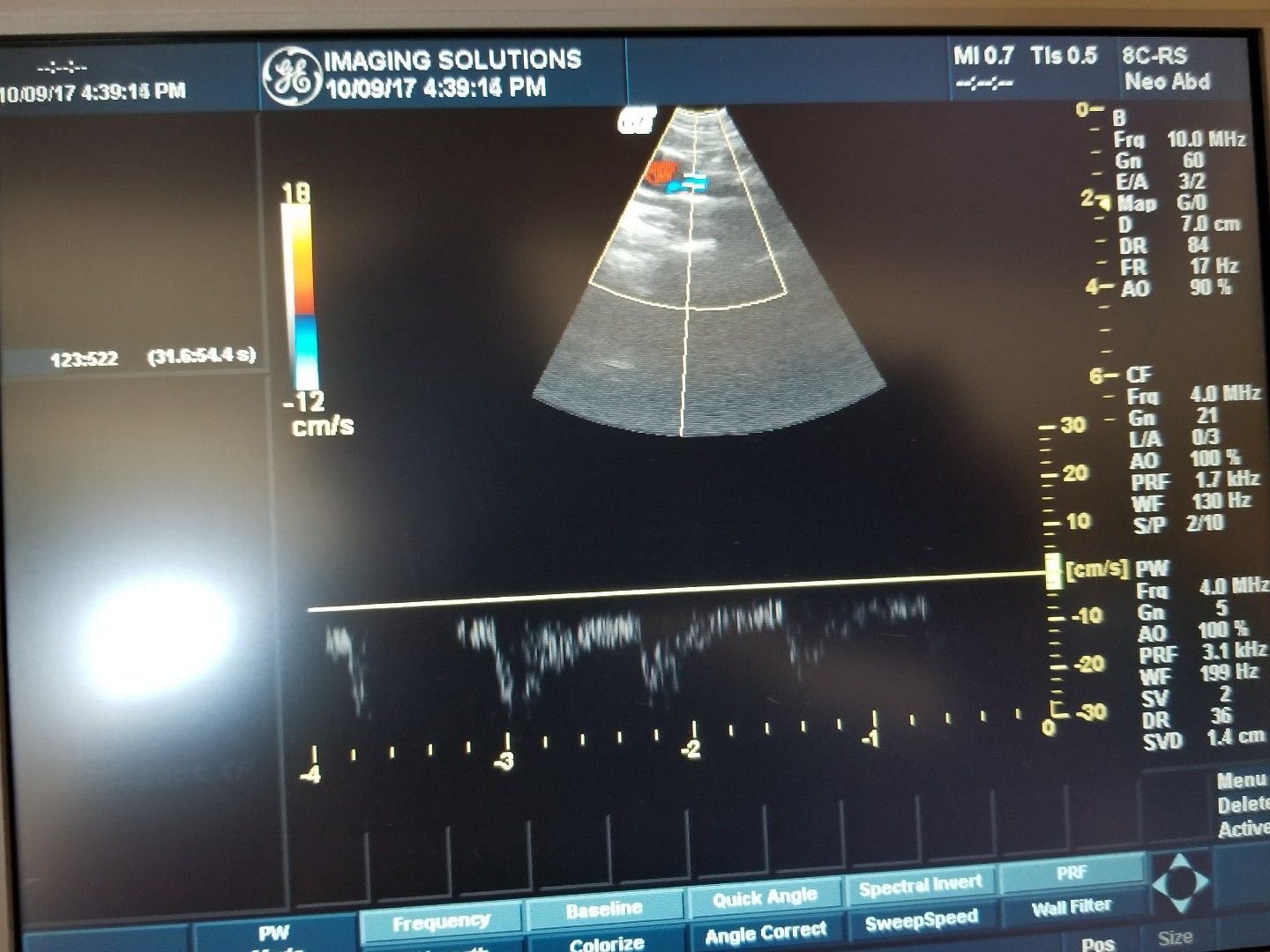 GE 8C-RS Probe / Transducer Micro-Convex DIAGNOSTIC ULTRASOUND MACHINES FOR SALE