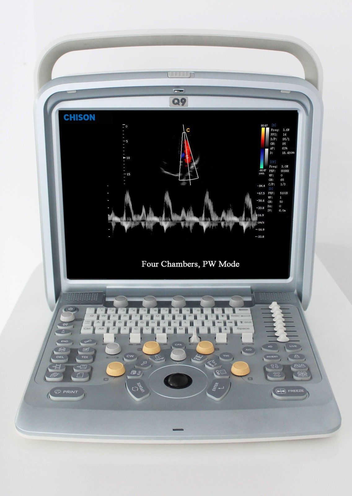 Chison Q9 Ultrasound System *NEW* DIAGNOSTIC ULTRASOUND MACHINES FOR SALE