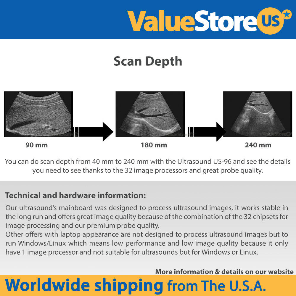 Ultrasound Scanner Veterinary Pregnancy US-96 with 7.5 MHz Rectal Probe. DIAGNOSTIC ULTRASOUND MACHINES FOR SALE