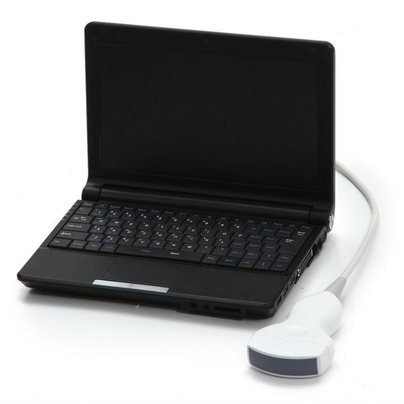 CE Full Digital Laptop Ultrasound Scanner Covex +Linear 2 Probe Sensor + 3D SW DIAGNOSTIC ULTRASOUND MACHINES FOR SALE