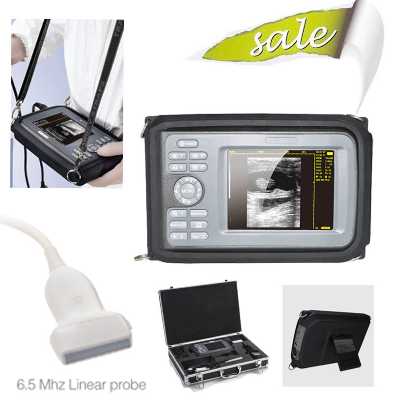 5.5'' TFT color LCD Palmtop Digital Ultrasound Scanner,Linear Probe,64 Images CE DIAGNOSTIC ULTRASOUND MACHINES FOR SALE