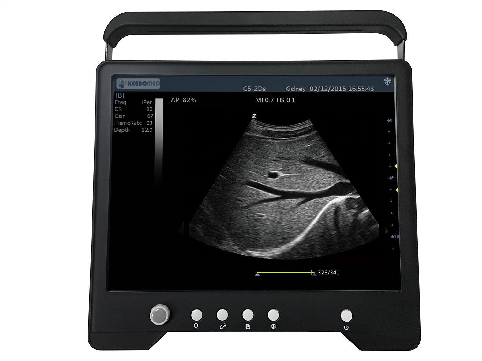 Veterinary TouchScreen Ultrasound&Micro-Convex Probe for Small Animals, KeeboMed DIAGNOSTIC ULTRASOUND MACHINES FOR SALE