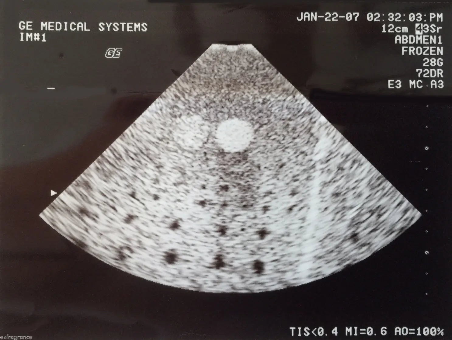 GE 3Sr Sector Cardiac Ultrasound Transducer Probe-Fully Tested For GE Logiq 700 DIAGNOSTIC ULTRASOUND MACHINES FOR SALE