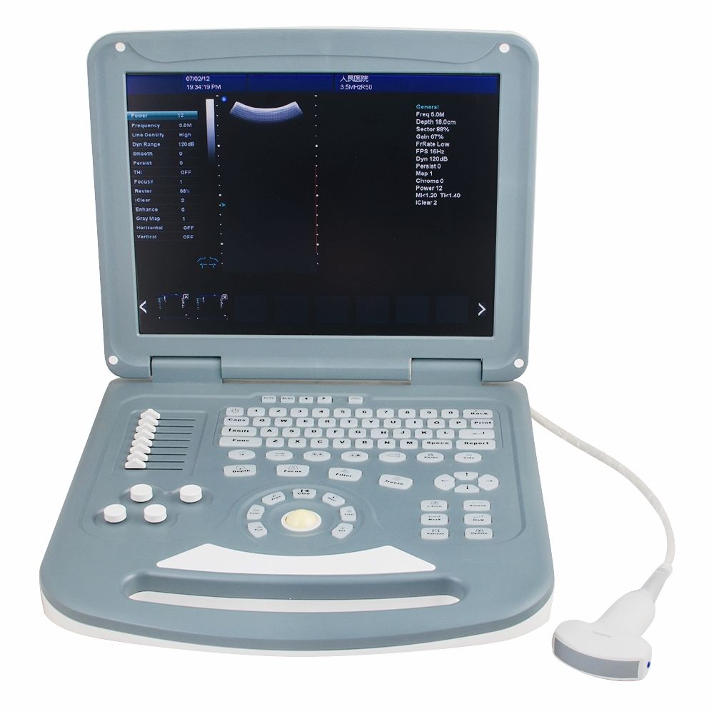 15" Color Doppler Ultrasound Diagnostic System Scanner Convex+ linear 2 Probe A+ 190891730787 DIAGNOSTIC ULTRASOUND MACHINES FOR SALE